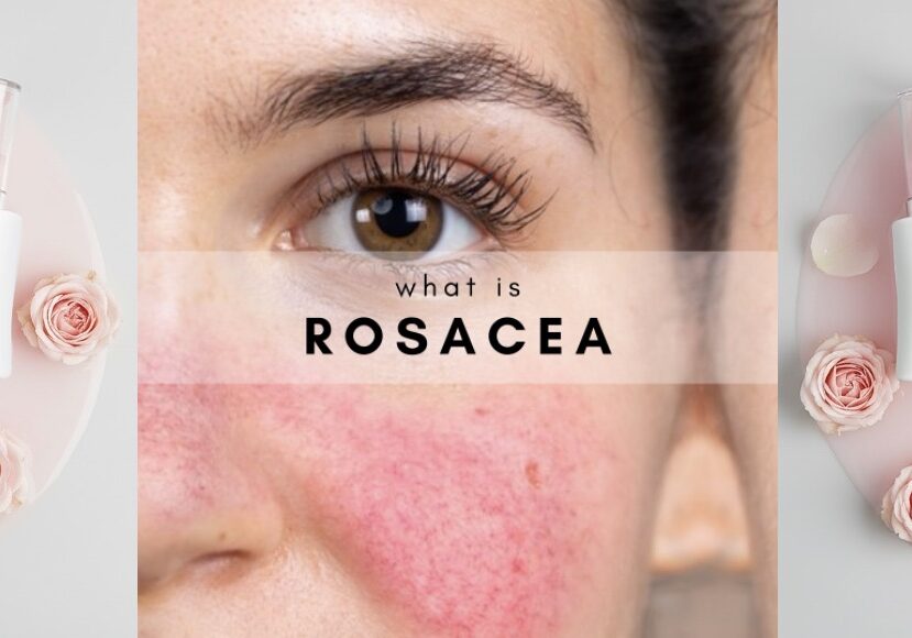 Skincare Rule #5 at John Francis Spa in San Francisco
